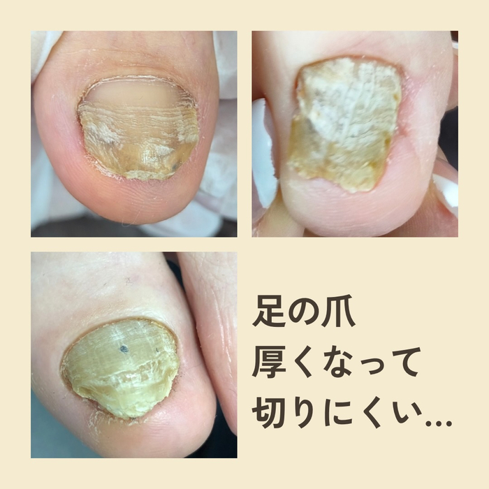 画像1845
