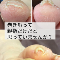 画像1851