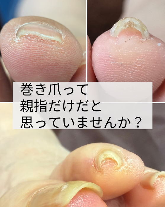 画像1851